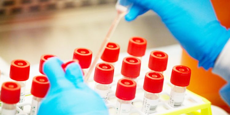 MSD KUZALISHA DAWA NA VIFAA KINGA DHIDI YA CORONA