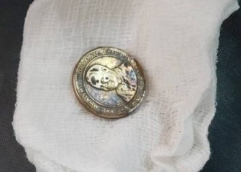 BMH YAFANIKIWA KUTOA SARAFU KOONI KWA MTOTO ILIYOKAA KWA SIKU 6