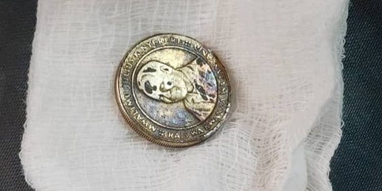 BMH YAFANIKIWA KUTOA SARAFU KOONI KWA MTOTO ILIYOKAA KWA SIKU 6